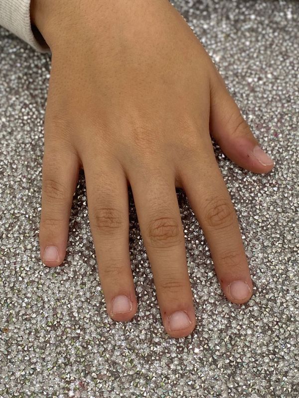Antes reconstruccion uñas acrilicas Después extensiones adhesivas
